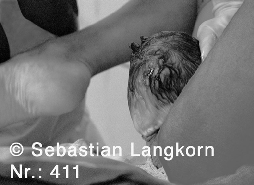 E0411GeburtSebastianLangkorn1987